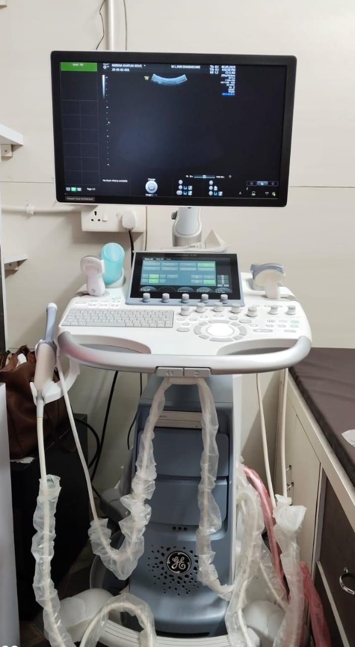 4D Ultrasound